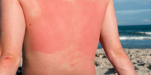 The Myth Behind Sunscreen Mist.